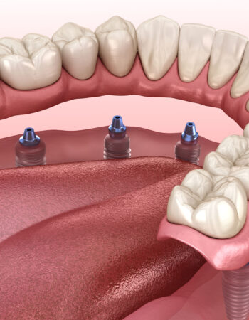 Sonoran Valley Dental Center