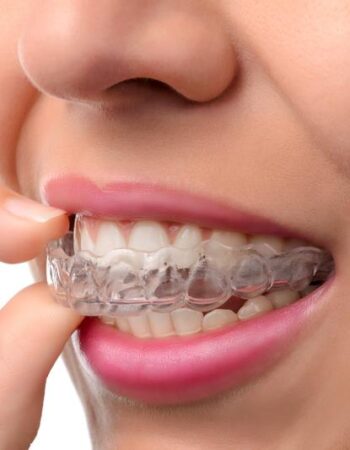 Wood Orthodontics – Anthem