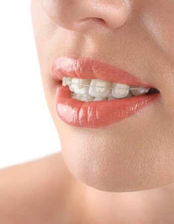 Wood Orthodontics – Anthem